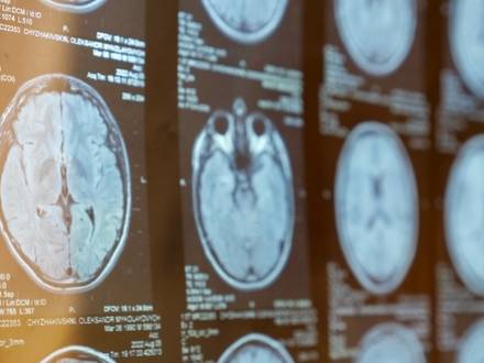 Lake Ridge, VA personal injury lawyer for car crash injuries